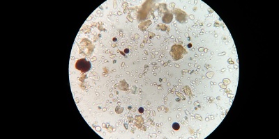 Soil microbes viewed under microscope. Photo by Malucero via Pixabay.