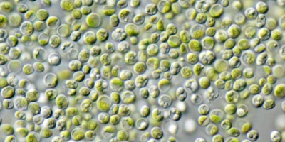 Image: NEON_ja, Chlorella vulgaris Beijerinck NIES-2170 / Olympus IX71+DP72, Wikimedia Commons, Creative Commons Attribution-Share Alike 3.0 Unported