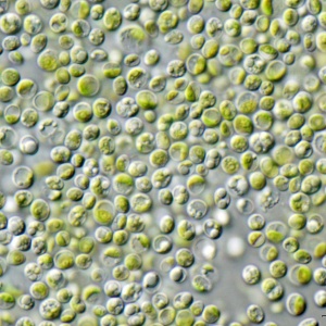 Image: NEON_ja, Chlorella vulgaris Beijerinck NIES-2170 / Olympus IX71+DP72, Wikimedia Commons, Creative Commons Attribution-Share Alike 3.0 Unported