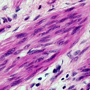 Image: Berkshire Community College Bioscience Image Library, cross section: smooth muscle magnification: 400x, Wikimedia Commons, Creative Commons CC0 1.0 Universal Public Domain Dedication