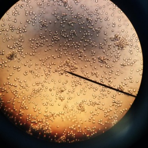 Image: Sam LaRussa, Yeast Cells Under the Microscope, Flickr, Creative Commons Attribution 2.0 Generic