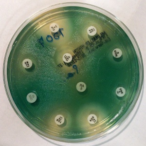 Image: Stefan Walkowski, Antibiogram of Pseudomonas aeruginosa on Mueller-Hinton agar, Wikimedia Commons, Creative Commons Attribution-Share Alike 4.0 International